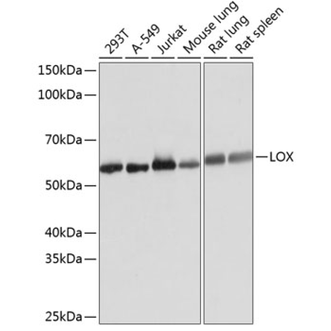 LOX Rabbit Monoclonal Antibody