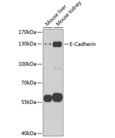 E-Cadherin Rabbit Polyclonal Antibody