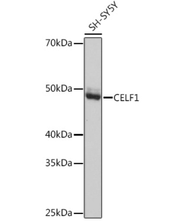 CELF1 Rabbit Monoclonal Antibody
