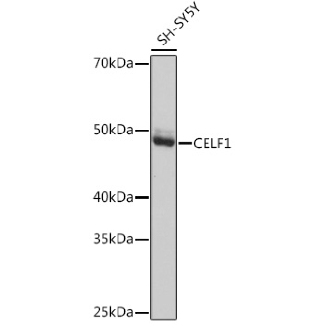 CELF1 Rabbit Monoclonal Antibody