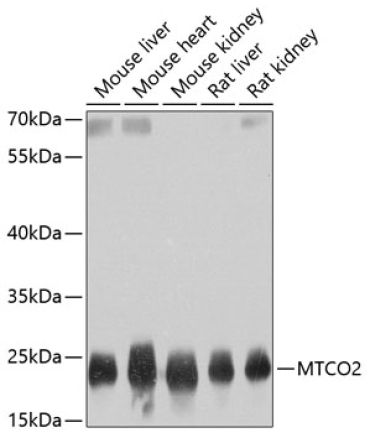 MTCO2 Rabbit Polyclonal Antibody