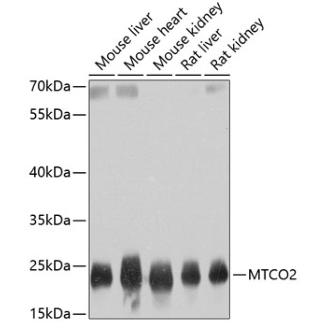 MTCO2 Rabbit Polyclonal Antibody
