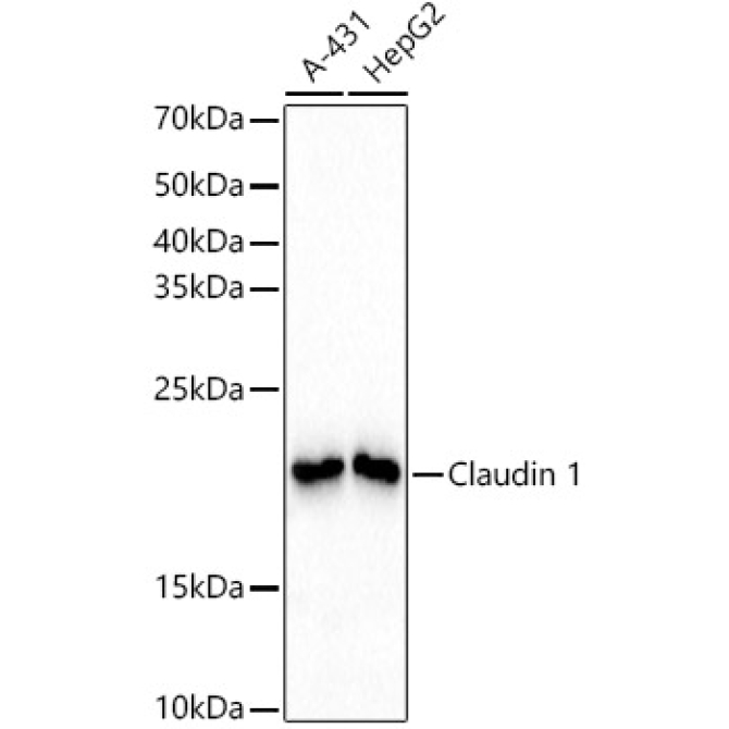Claudin 1 Rabbit Monoclonal Antibody