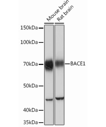 BACE1 Rabbit Monoclonal Antibody