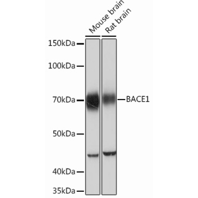 BACE1 Rabbit Monoclonal Antibody