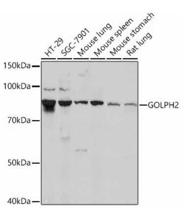 GOLPH2 Rabbit Monoclonal Antibody