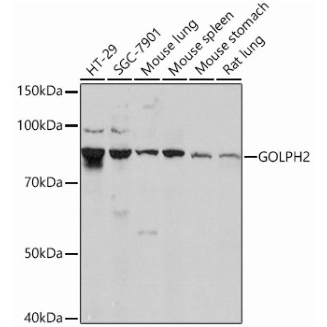 GOLPH2 Rabbit Monoclonal Antibody