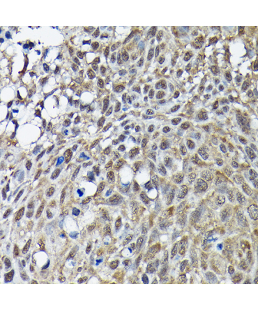 BRCA1 Rabbit Polyclonal Antibody