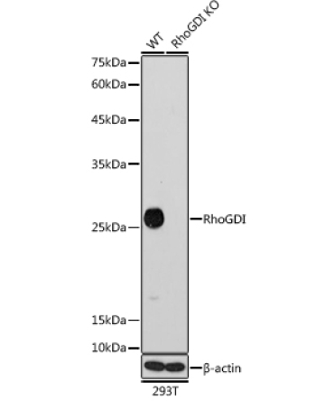 RhoGDI Rabbit Monoclonal Antibody [KO Validated]