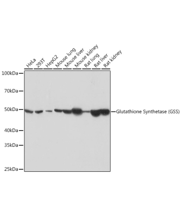 Glutathione Synthetase (GSS) Rabbit Monoclonal Antibody