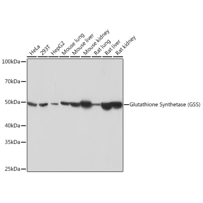 Glutathione Synthetase (GSS) Rabbit Monoclonal Antibody
