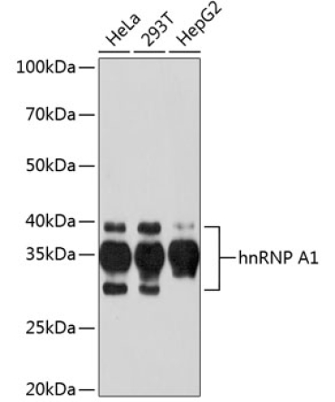 hnRNP A1 Rabbit Monoclonal Antibody