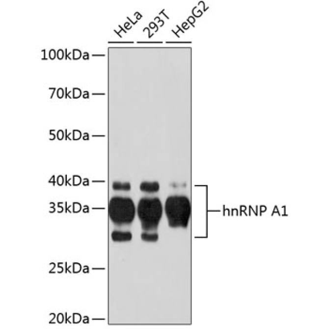 hnRNP A1 Rabbit Monoclonal Antibody