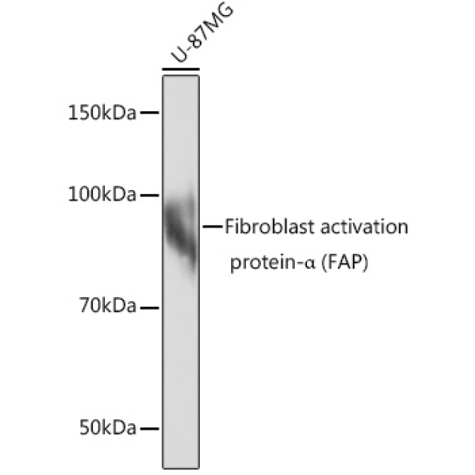 Fibroblast activation protein-Alpha (FAP) Rabbit Monoclonal Antibody