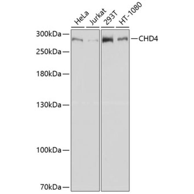 CHD4 Rabbit Polyclonal Antibody