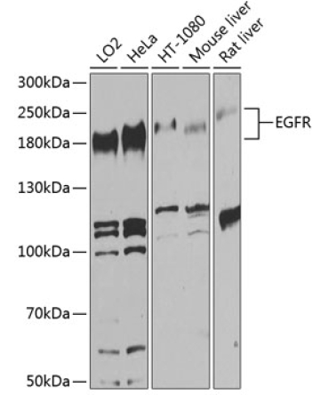 EGFR Rabbit Polyclonal Antibody