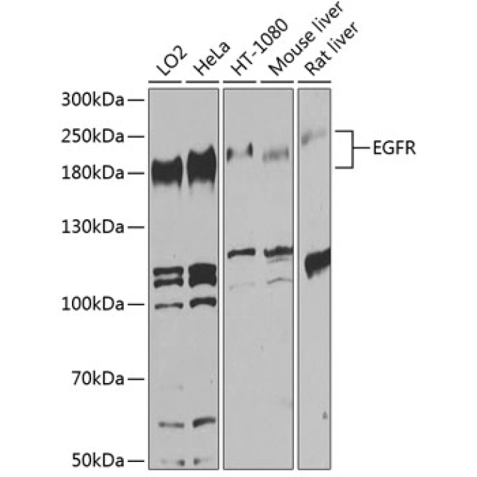 EGFR Rabbit Polyclonal Antibody