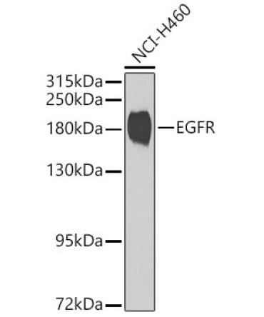 EGFR Rabbit Polyclonal Antibody [KD Validated]