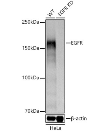 EGFR Rabbit Polyclonal Antibody [KD Validated]