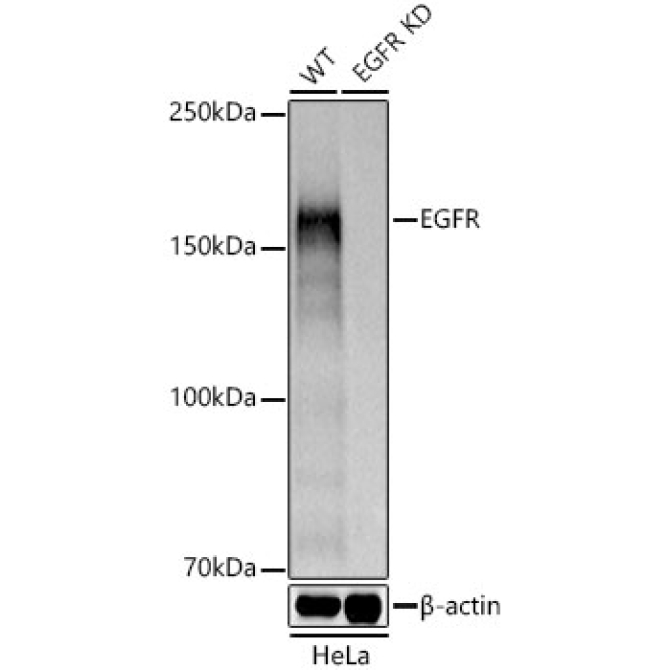 EGFR Rabbit Polyclonal Antibody [KD Validated]