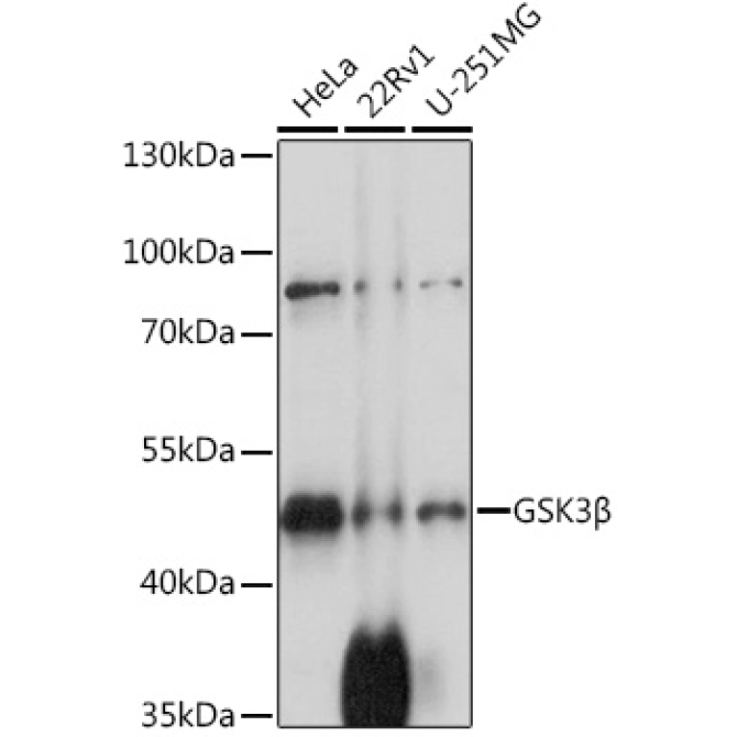 GSK3Beta Rabbit Polyclonal Antibody