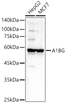A1BG Rabbit Polyclonal Antibody