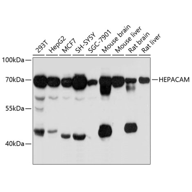 HEPACAM Rabbit Polyclonal Antibody