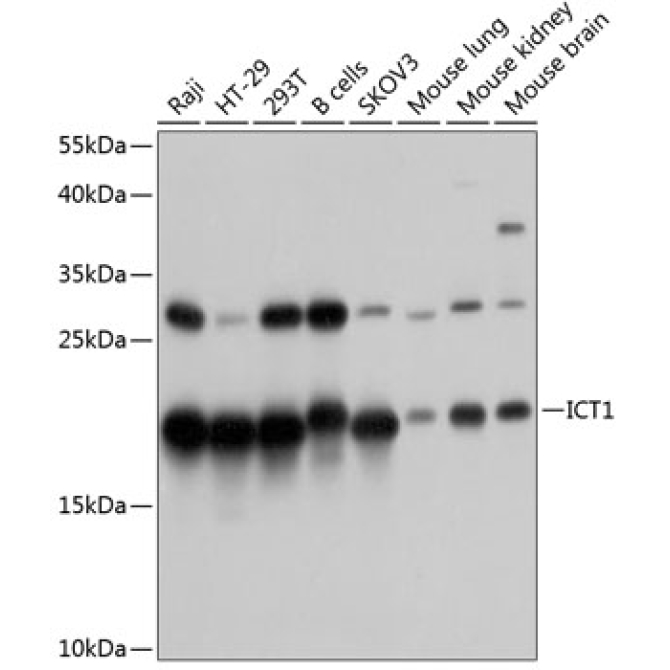 ICT1 Rabbit Polyclonal Antibody