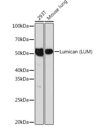 Lumican (LUM) Rabbit Monoclonal Antibody
