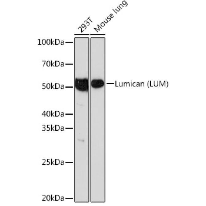 Lumican (LUM) Rabbit Monoclonal Antibody