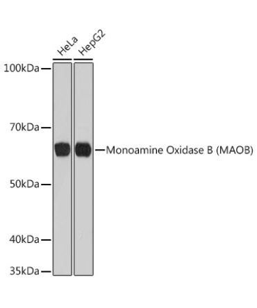 Monoamine Oxidase B (MAOB) Rabbit Monoclonal Antibody