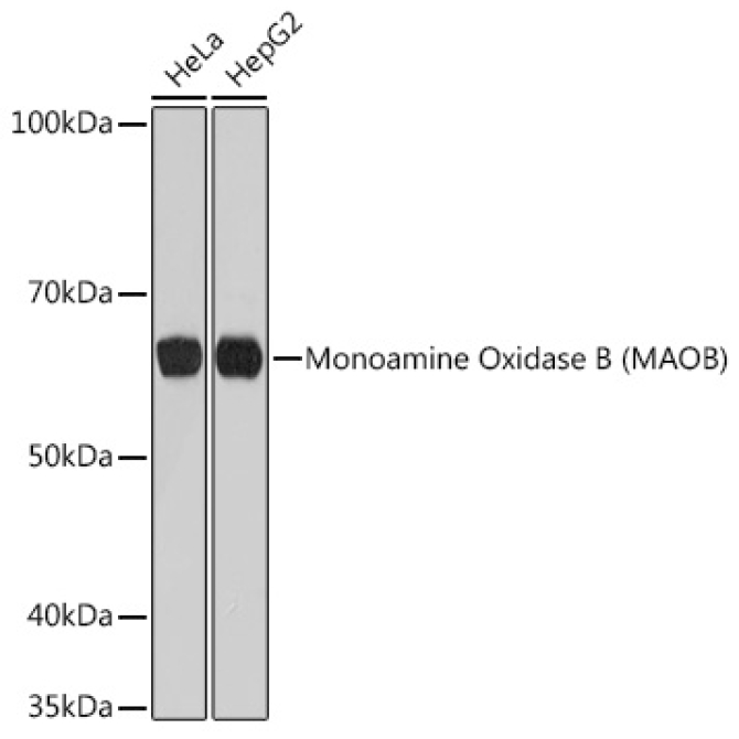 Monoamine Oxidase B (MAOB) Rabbit Monoclonal Antibody