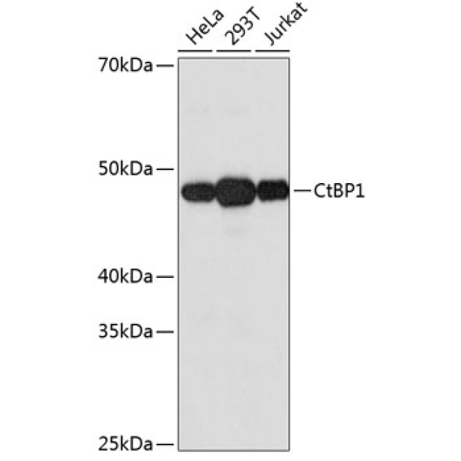 CtBP1 Rabbit Monoclonal Antibody