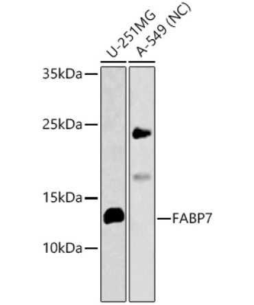 FABP7 Rabbit Polyclonal Antibody