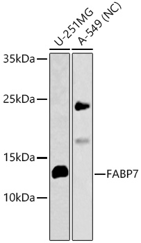 FABP7 Rabbit Polyclonal Antibody
