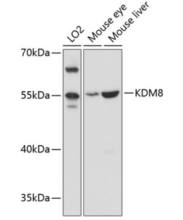 KDM8 Rabbit Polyclonal Antibody