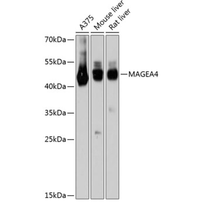 MAGEA4 Rabbit Polyclonal Antibody