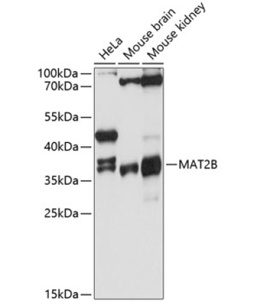 MAT2B Rabbit Polyclonal Antibody