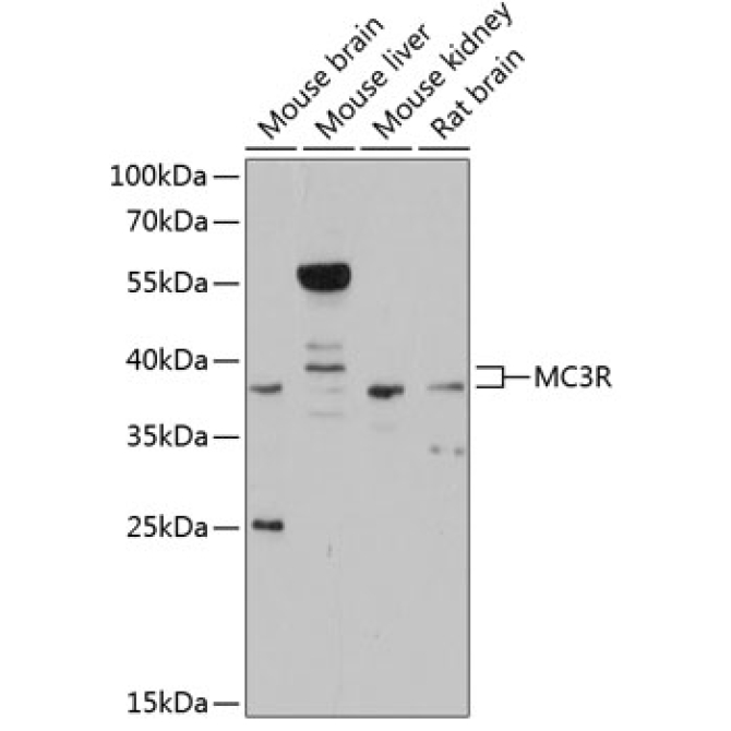 MC3R Rabbit Polyclonal Antibody
