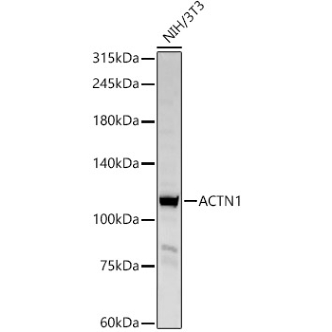 ACTN1 Rabbit Polyclonal Antibody