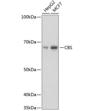 CBS Rabbit Monoclonal Antibody