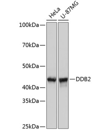 DDB2 Rabbit Monoclonal Antibody