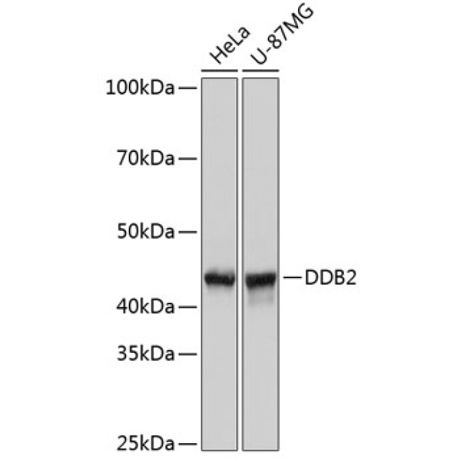 DDB2 Rabbit Monoclonal Antibody