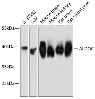 ALDOC Rabbit Polyclonal Antibody