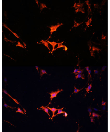 LAMTOR1 Rabbit Polyclonal Antibody