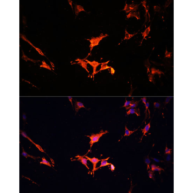 LAMTOR1 Rabbit Polyclonal Antibody