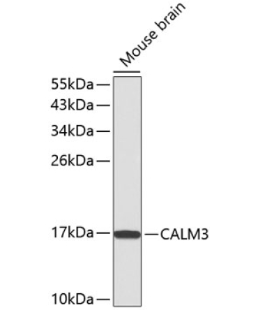 CALM3 Rabbit Polyclonal Antibody