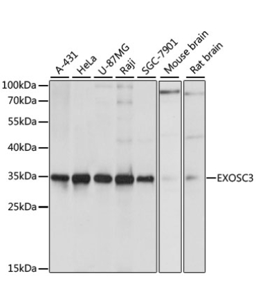 EXOSC3 Rabbit Polyclonal Antibody