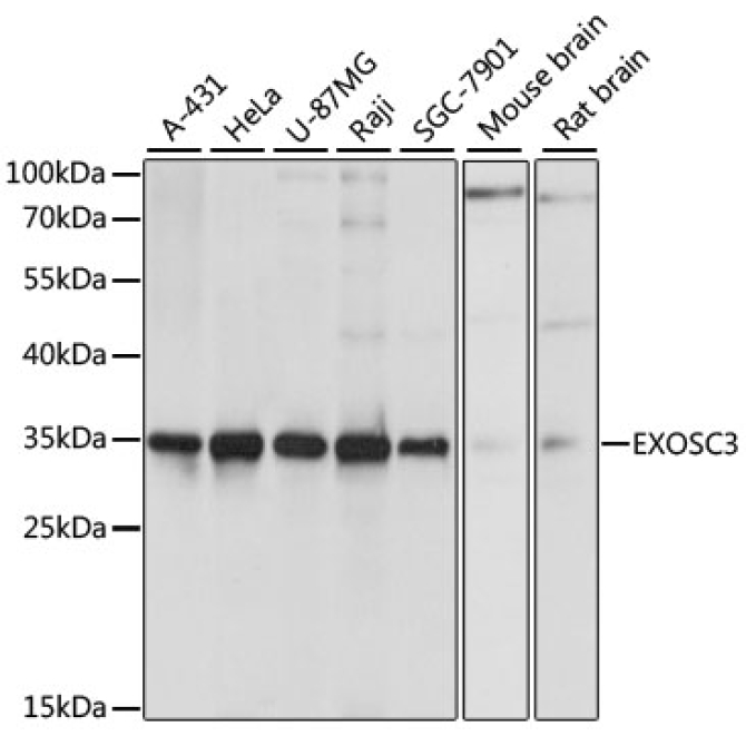 EXOSC3 Rabbit Polyclonal Antibody