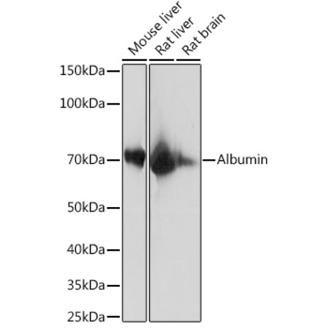 Albumin Rabbit Monoclonal Antibody